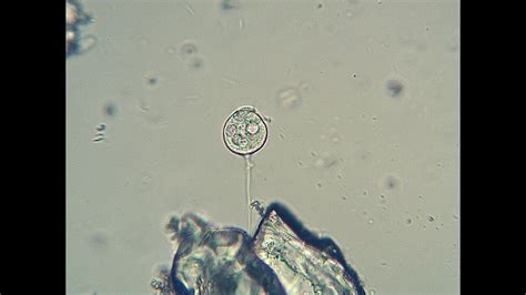  Vorticella! Een MiniatuurVortex die Je Kruist met een Microscoop