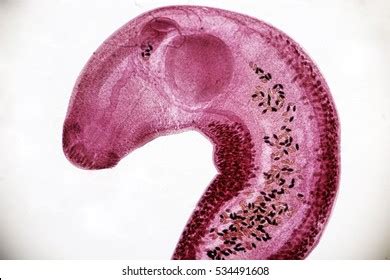  Echinostoma: Een parasiet met een reislustige levenswijze die zich graag in de darmen van zijn gastheer nestelt!